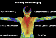Thermography Screenings
